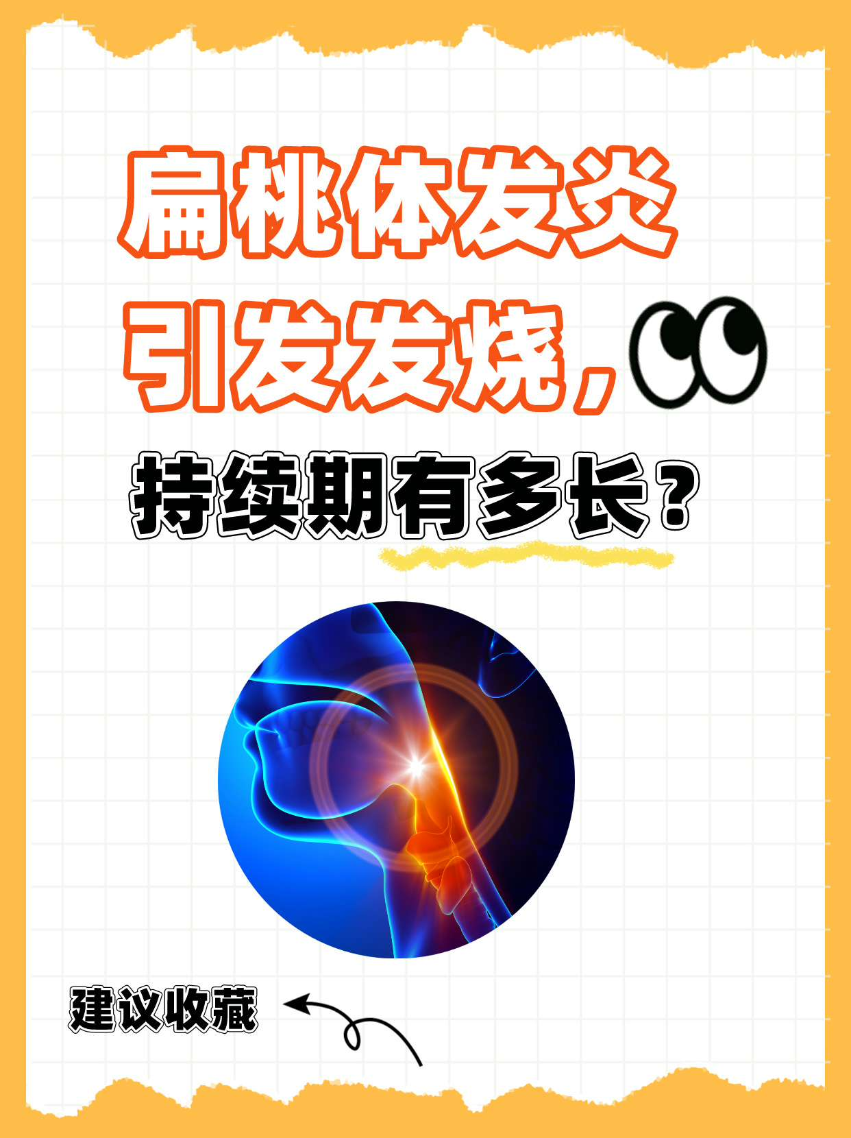 扁桃体发炎引发发烧，持续期有多长？