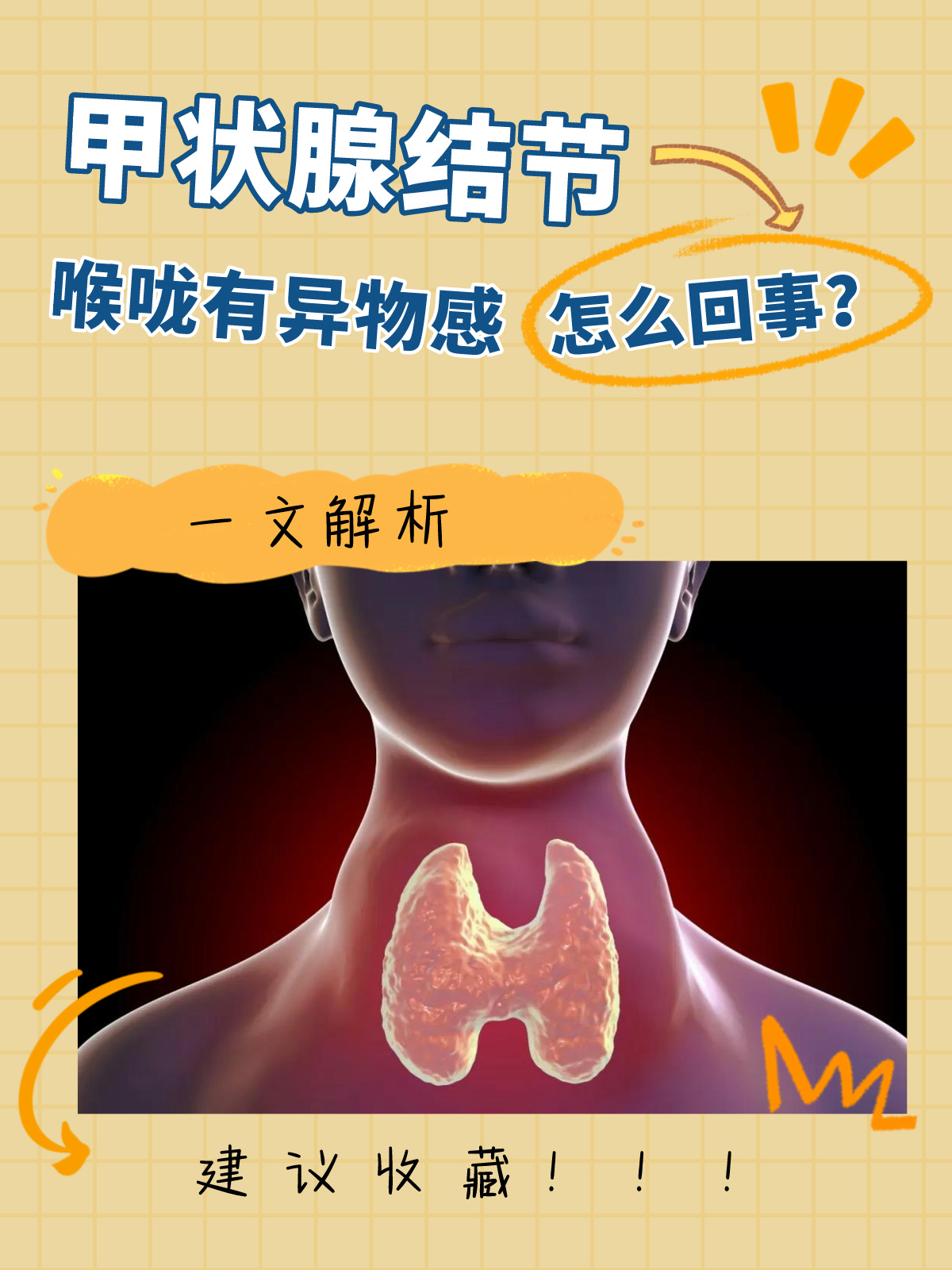 一文解析：甲状腺结节喉咙有异物感怎么回事？