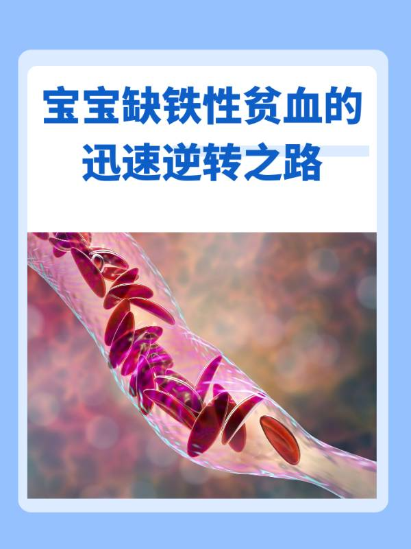 宝宝缺铁性贫血的迅速逆转之路