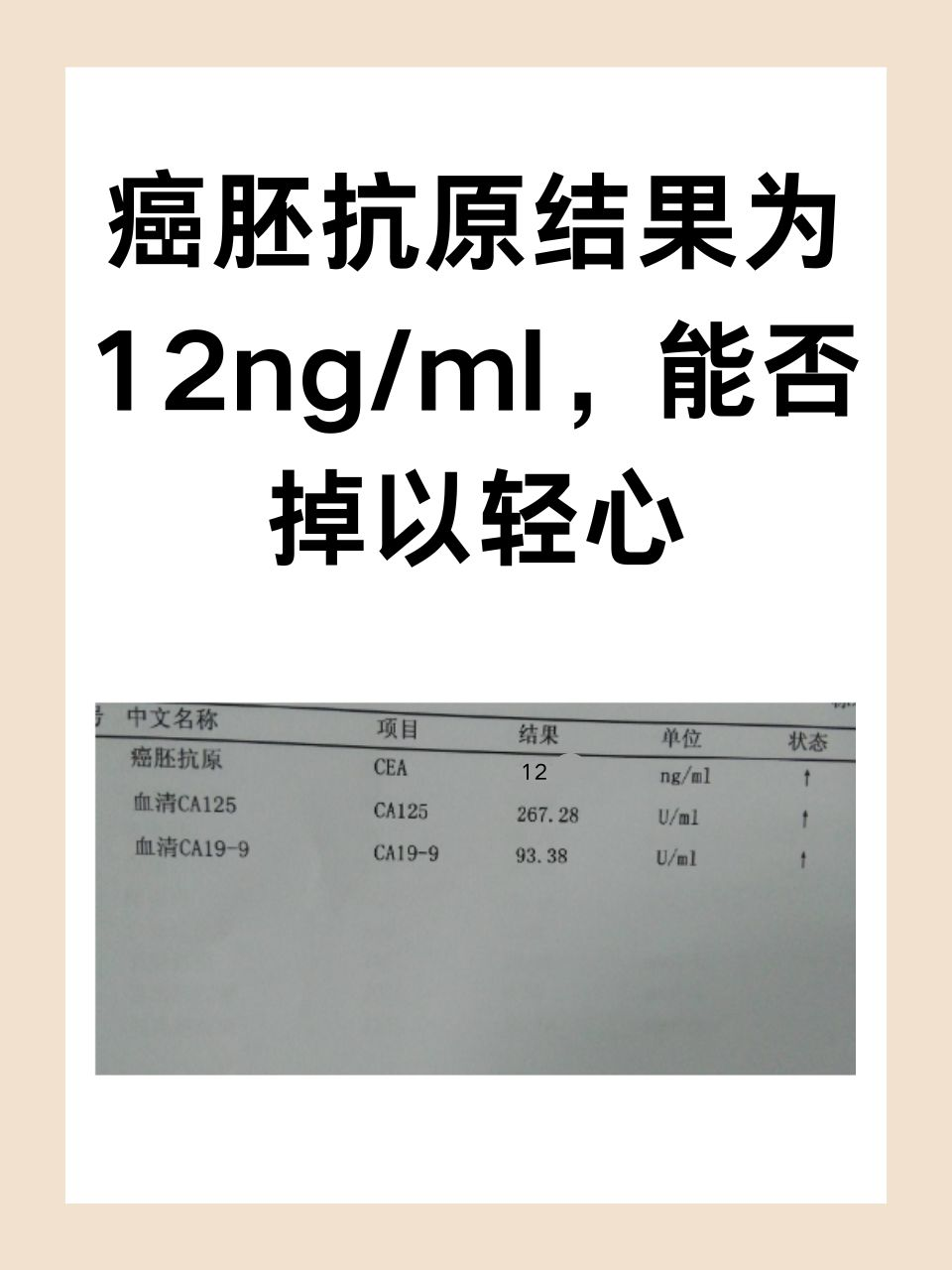 癌胚抗原结果为12ng/ml，能否掉以轻心