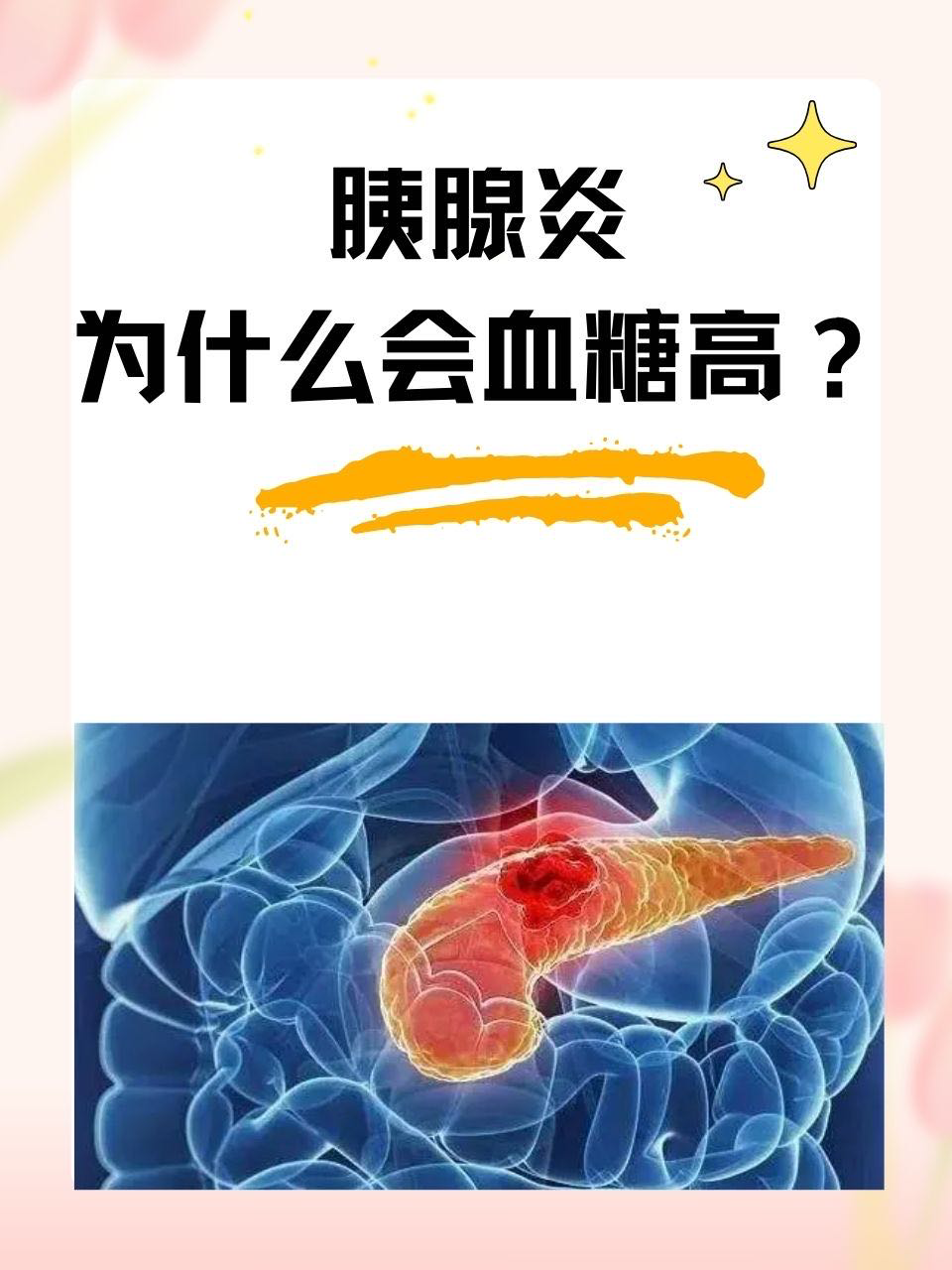 胰腺炎为什么会血糖高？