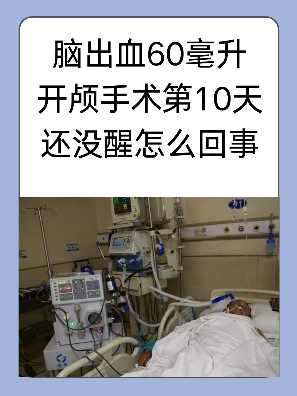 脑出血60毫升开颅手术第10天还没醒怎么回事