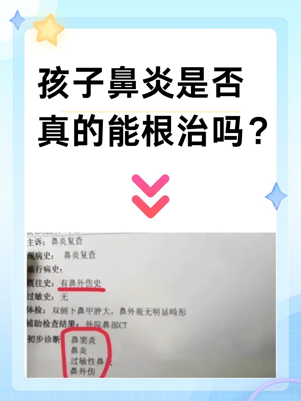 孩子鼻炎是否真的能根治吗？