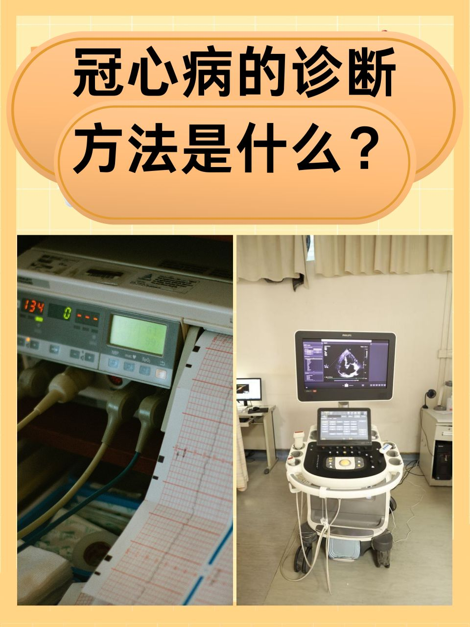 冠心病的诊断方法是什么