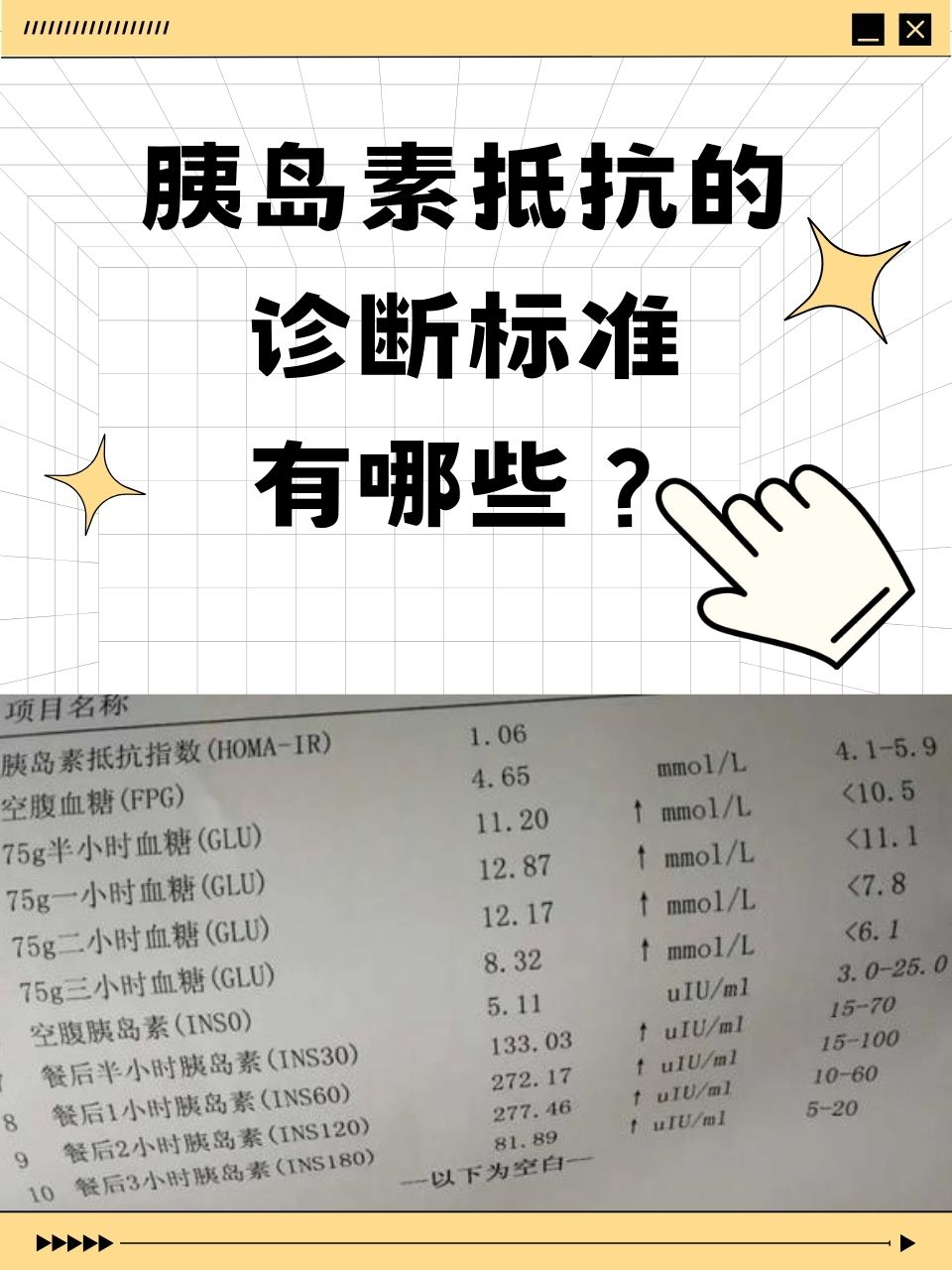 胰岛素抵抗的诊断标准有哪些？