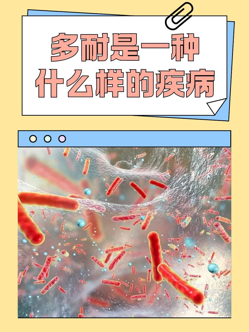 多耐是一种什么样的疾病