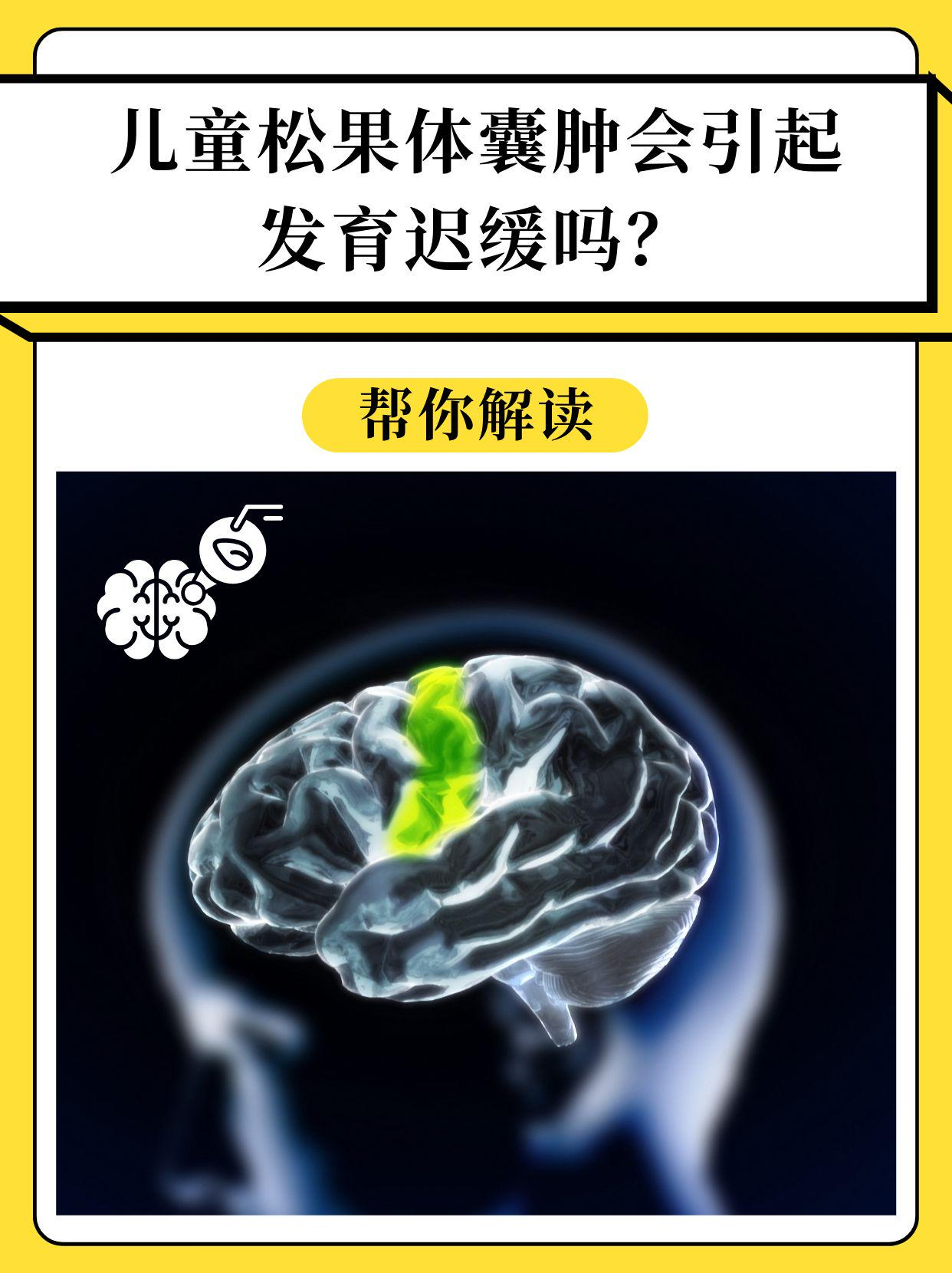 儿童松果体囊肿会引起发育迟缓吗？帮你解读