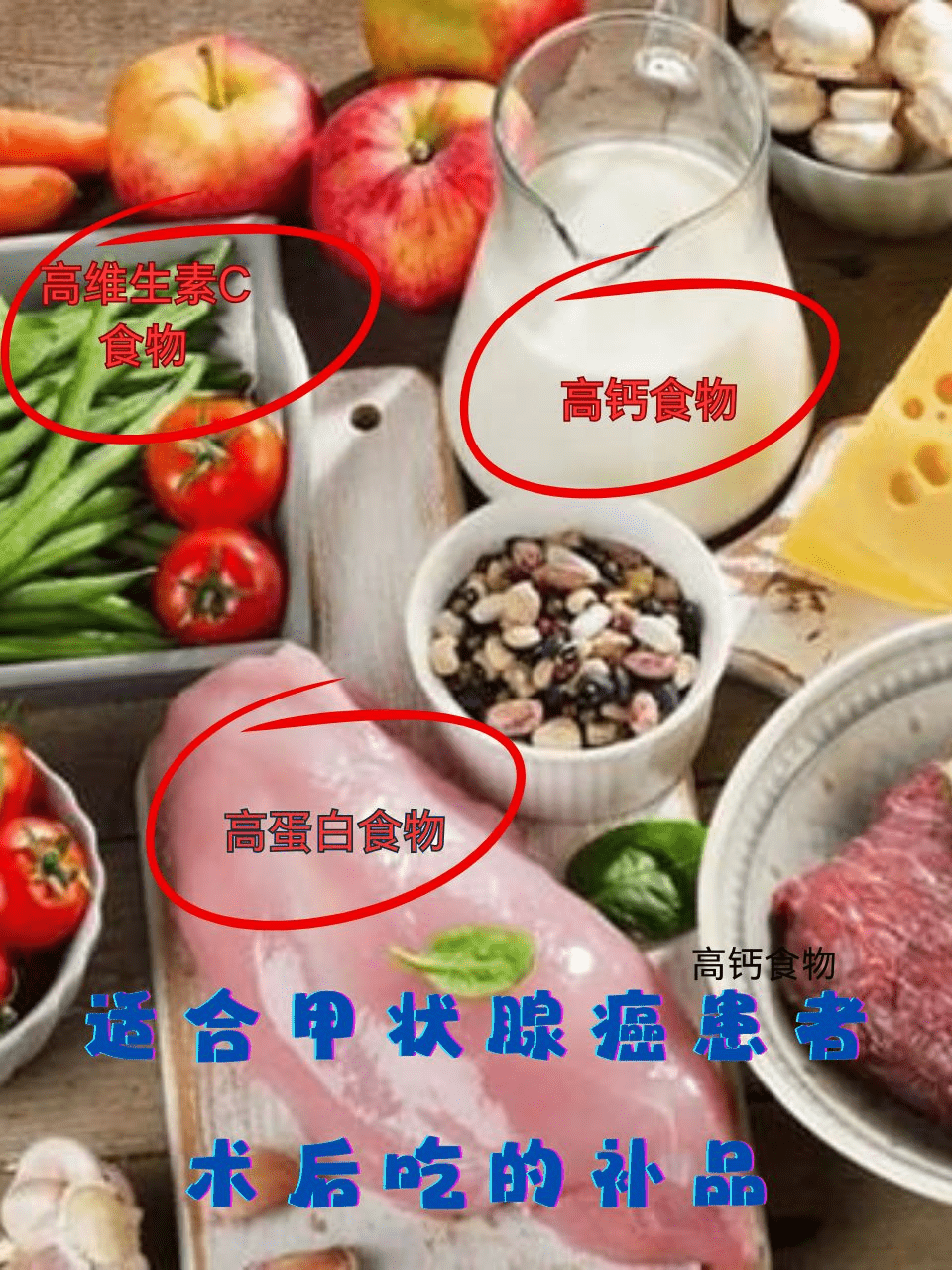 甲状腺癌术后吃什么？这些营养补品必不可少！