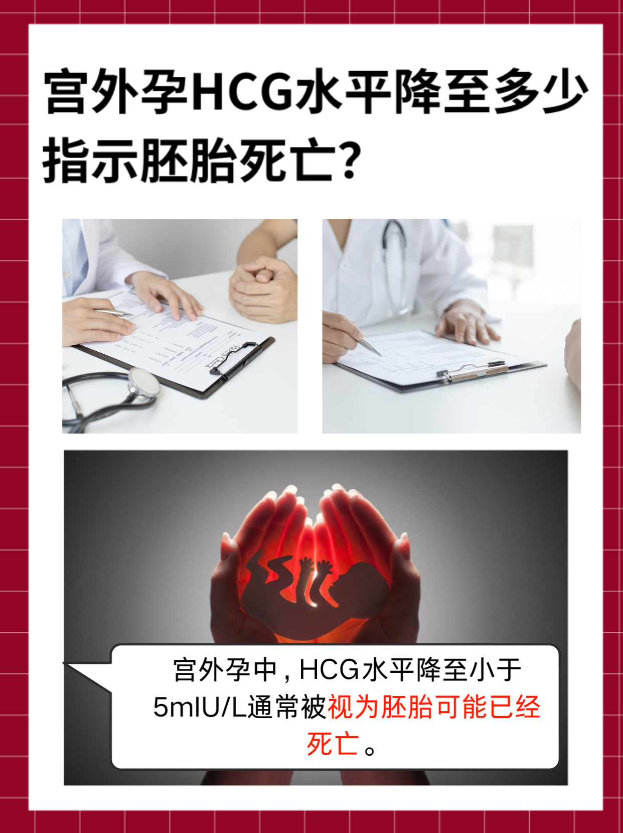 宫外孕HCG水平降至多少指示胚胎死亡？