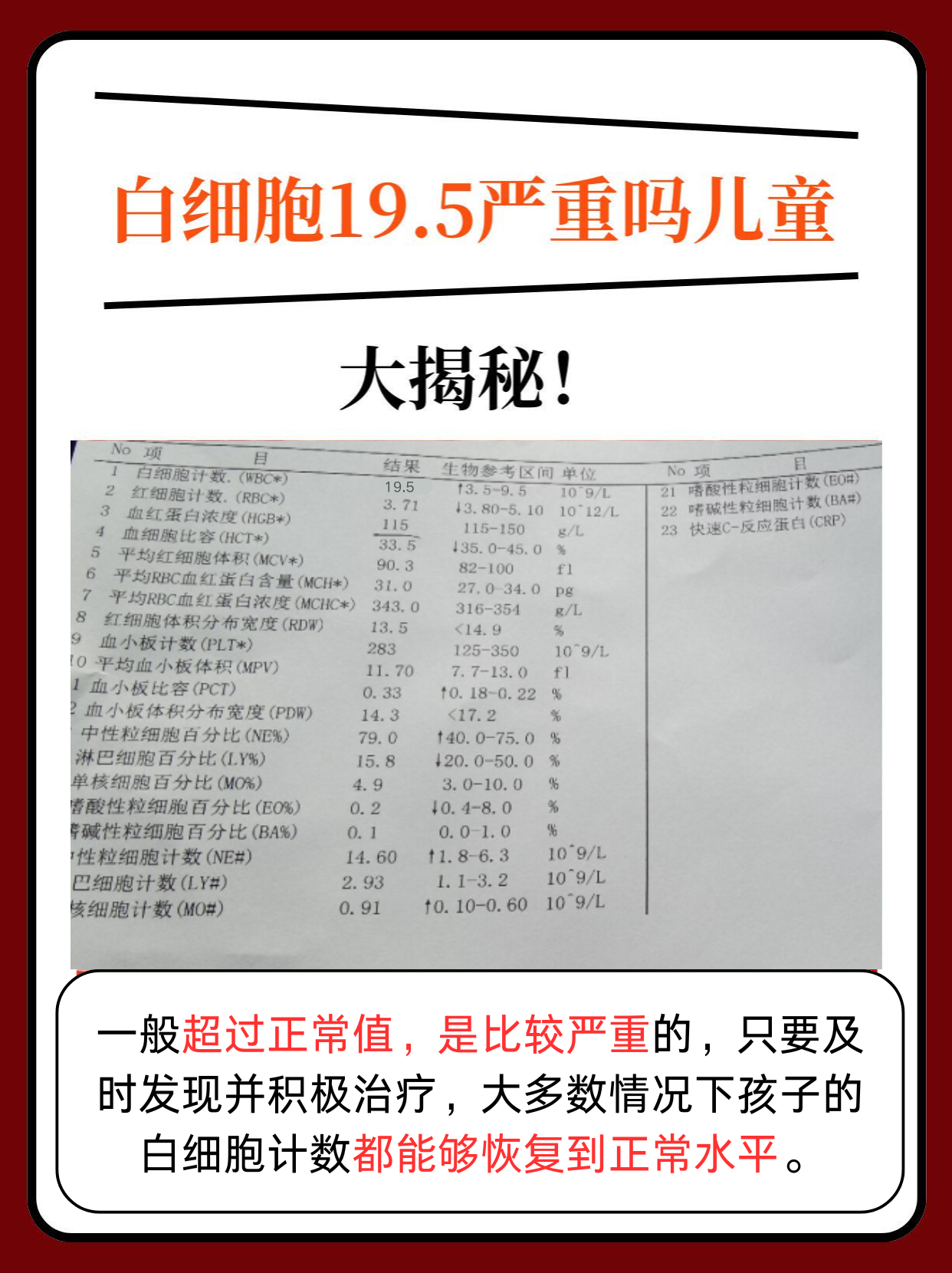 儿童白细胞19.5×10^9严重吗？真相揭秘